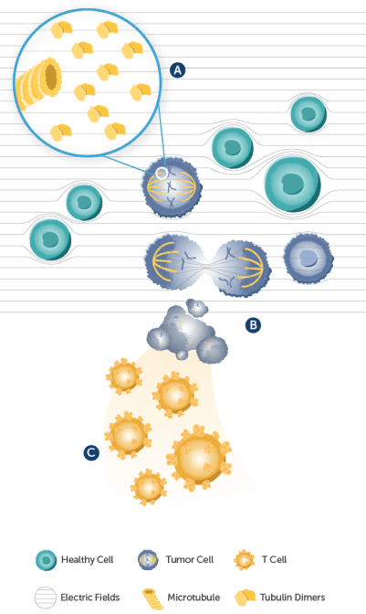 Illustration of Tumor Treating Fields disrupting cancer cell division and mitosis in NSCLC patients.