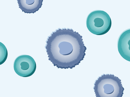Illustration showing tumor treating fields (TTFields) mechanism of action inhibiting cancer cell division